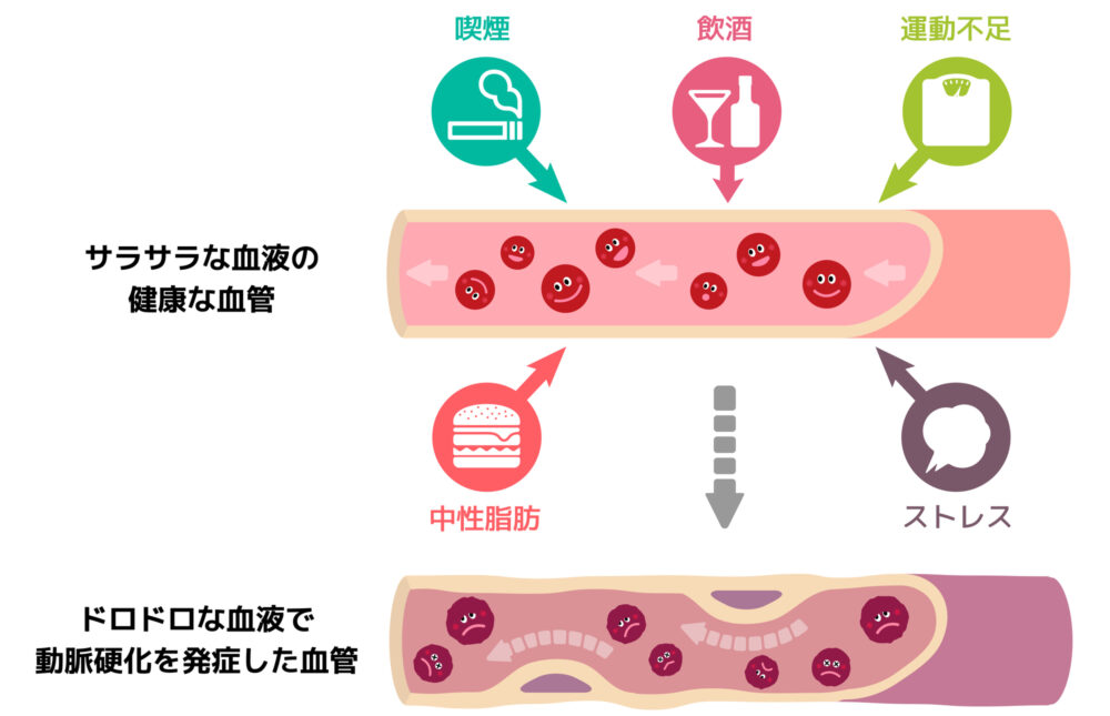 なぜ高血圧がいけないか